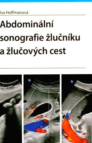 Abdominální sonografie žlučníku a žlučových cest