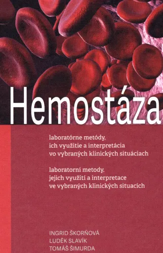 Hemostáza laboratórne metódy, ich využitie a interpretácia vo vybraných klinických situáciach = laboratorní metody, jejich využití a interpretace ve vybraných klinických situacích