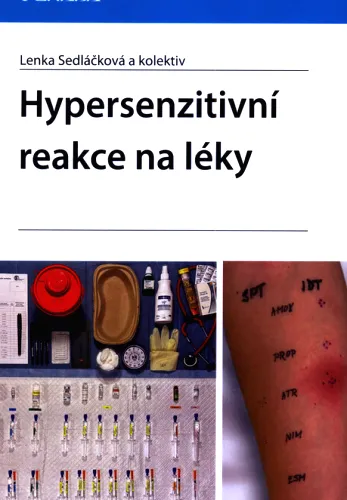 Hypersenzitivní reakce na léky